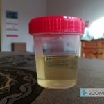 What does normal urine look like in cats?